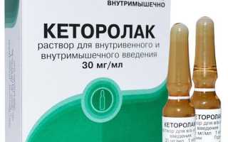Кеторолак: описание, инструкция и аналоги препарата