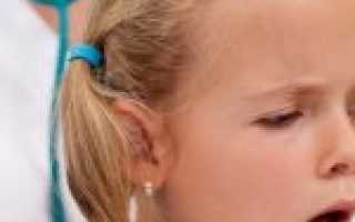 Туберкулез – симптомы у детей и первые признаки: как выявить